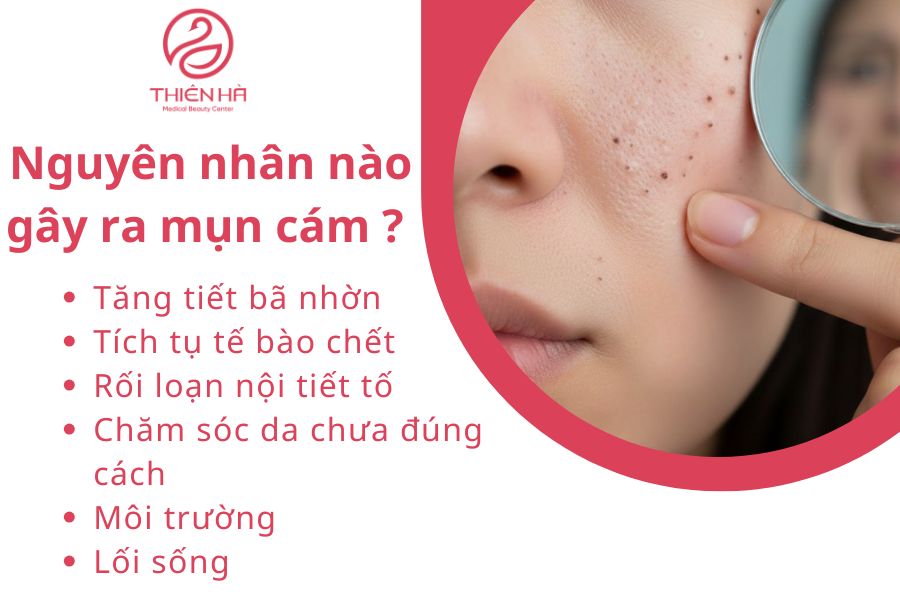 Nguyên nhân nào gây ra mụn cám 
