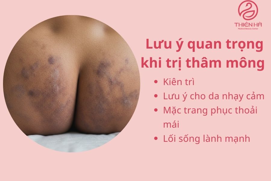 Lưu ý quan trọng khi trị thâm mông 