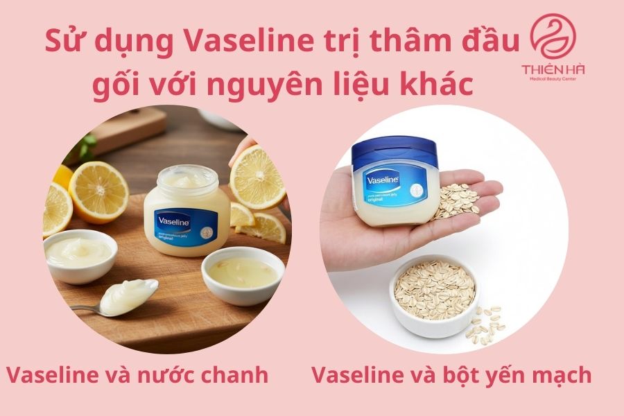 Cách sử dụng Vaseline trị thâm đầu gối với các nguyên liệu khác 