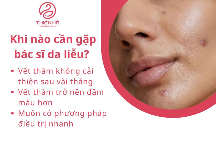 Dấu hiệu cần gặp bác sĩ da liễu 