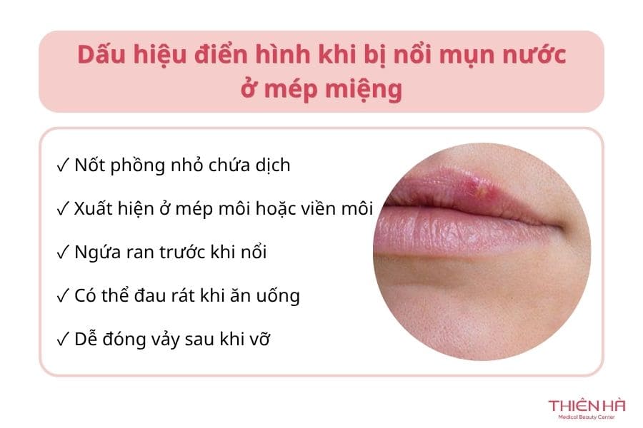 Bị nổi mụn nước ở mép miệng: Cách nhận biết và điều trị 1 Mụn nước ở mép miệng trông như thế nào?