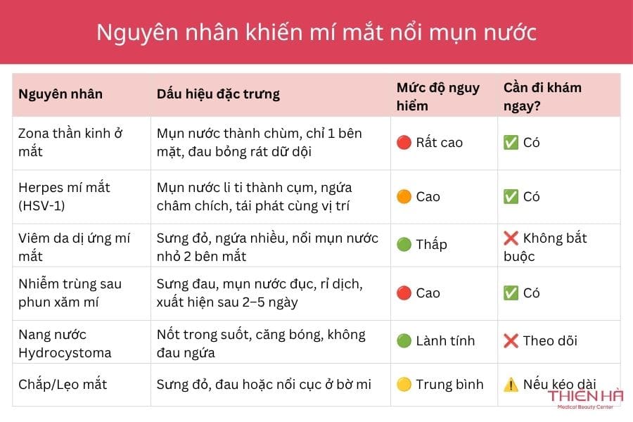 Mí mắt nổi mụn nước: Nguyên nhân thường gặp và cách xử lý đúng 2 Nguyên nhân khiến mí mắt nổi mụn nước