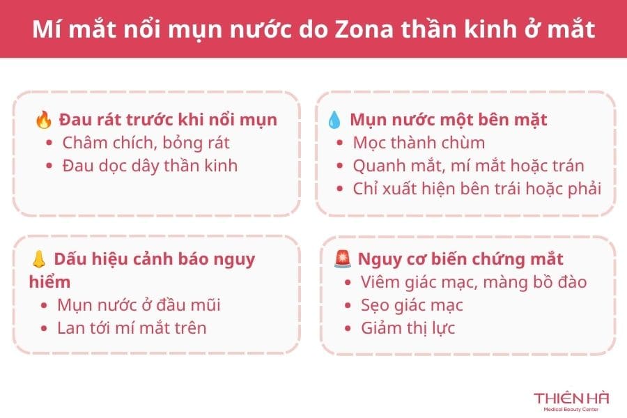Mí mắt nổi mụn nước: Nguyên nhân thường gặp và cách xử lý đúng 3 Nguyên nhân khiến mí mắt nổi mụn nước là do bệnh Zona thần kinh ở mắt