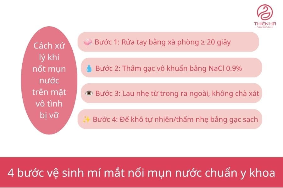 Mí mắt nổi mụn nước: Nguyên nhân thường gặp và cách xử lý đúng 7 Cách vệ sinh vùng mắt bằng nước muối sinh lý chuẩn y khoa