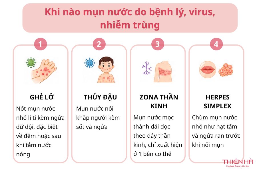 Mụn nước có thể xuất phát từ nguyên nhân bệnh lý, virus hoặc nhiễm trùng
