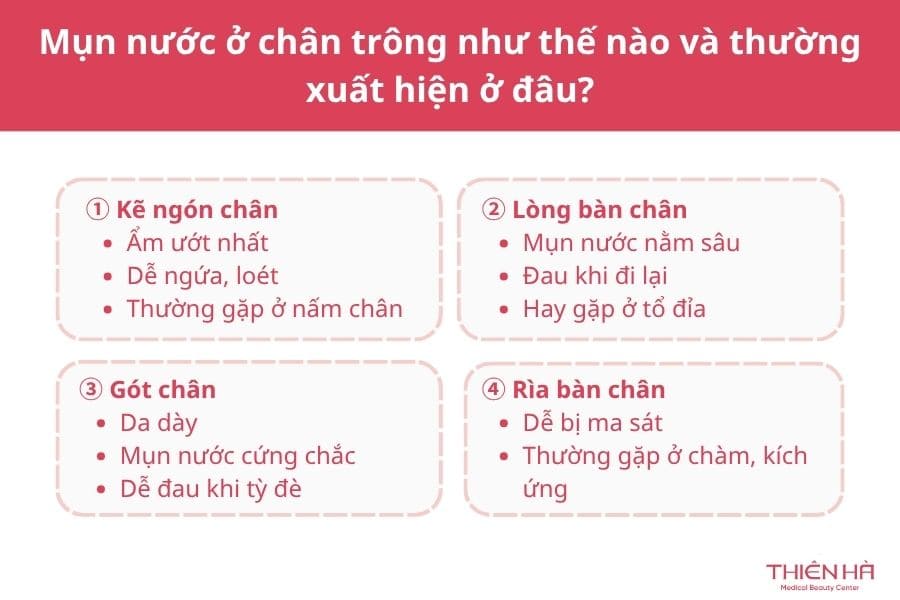 Mụn nước ở chân ngứa ngáy là bệnh gì? Cách chữa dứt điểm 1 Mụn nước ở chân trông như thế nào và thường xuất hiện ở đâu?
