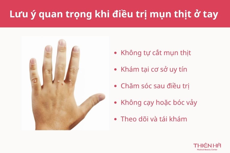 Mụn thịt ở tay: Nguyên nhân, cách nhận biết và phương pháp điều trị hiệu quả 5 Lưu ý quan trọng khi điều trị mụn thịt ở tay