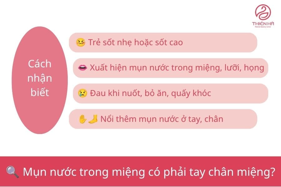 Nổi mụn nước trong miệng: Nguyên nhân, dấu hiệu và cách xử lý 4 Mụn nước trong miệng là dấu hiệu của bệnh tay chân miệng - Chủ yếu ở trẻ em, lây rất mạnh