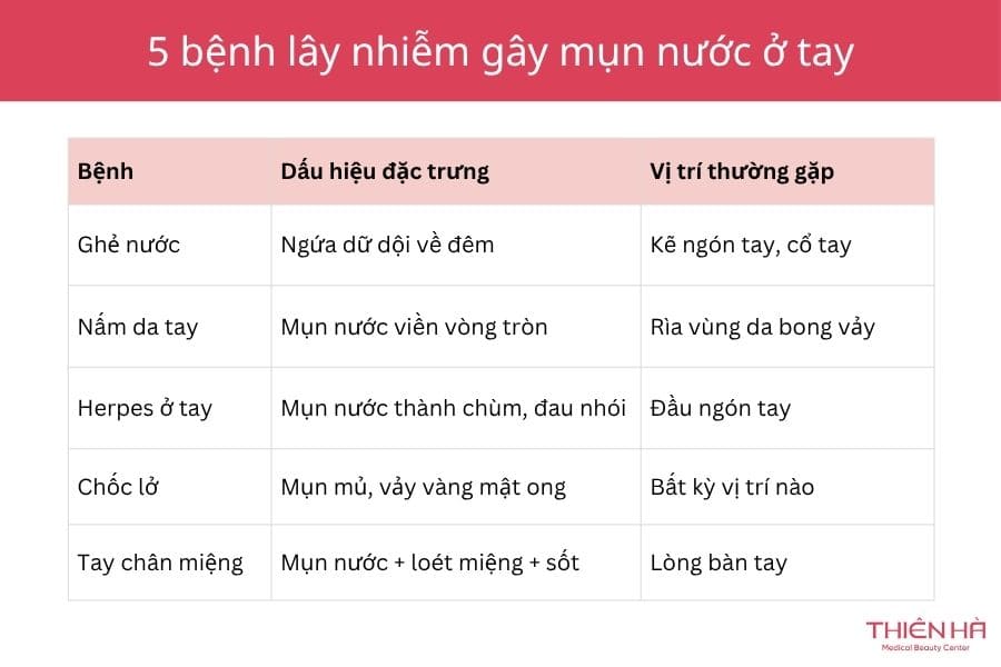 Tay bị nổi mụn nước do vi khuẩn, virus, nấm và có khả năng lây nhiễm