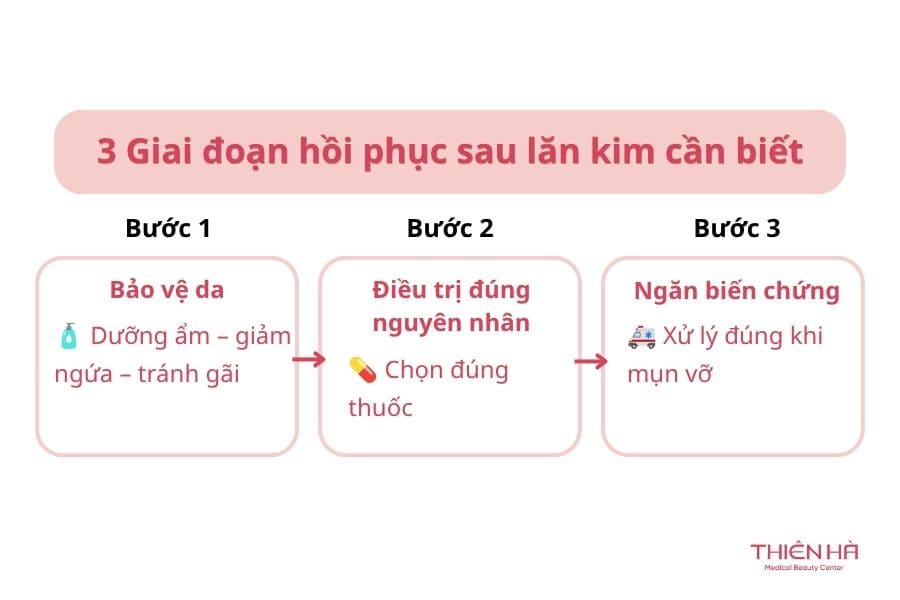 Hướng dẫn cách trị mụn nước ở tay an toàn