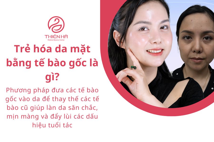 Trẻ hóa da mặt bằng tế bào gốc: Giải đáp từ Bác sĩ Da liễu đầu ngành 1 Trẻ hóa da mặt bằng tế bào gốc giúp tái cấu trúc làn da toàn diện