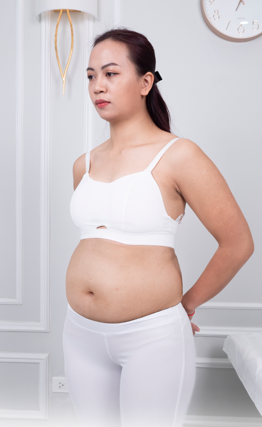 Giảm mỡ – 3 liệu trình – Lấy lại vóc dáng thon gọn - trước