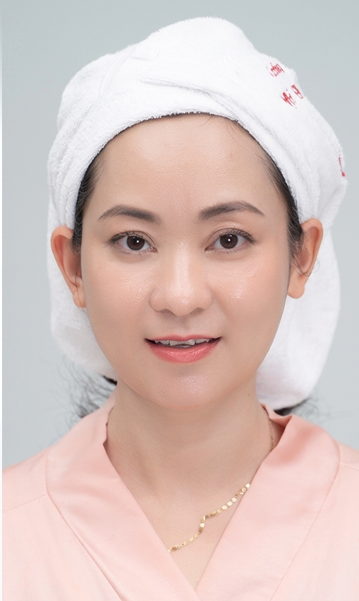 Trị Nám – 4 liệu trình – Da sáng tự tin - sau