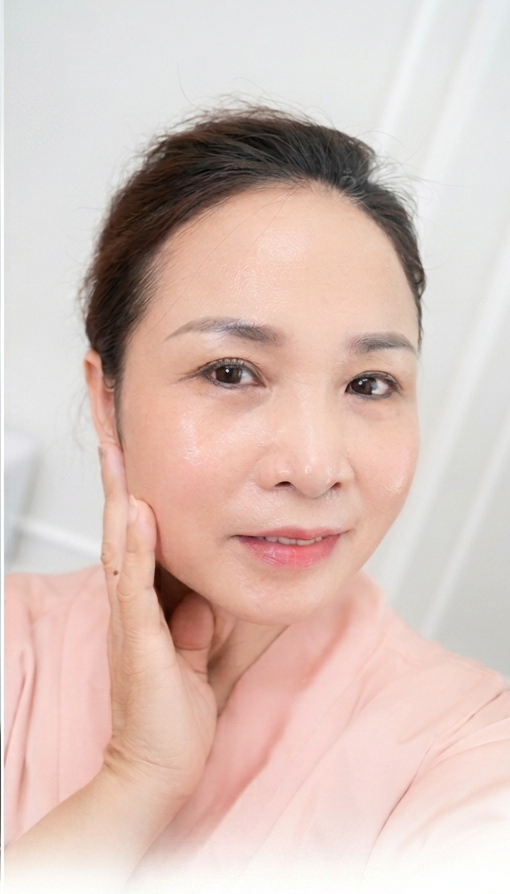 Trị Nám – 2 liệu trình – Da đều màu sáng mịn - sau