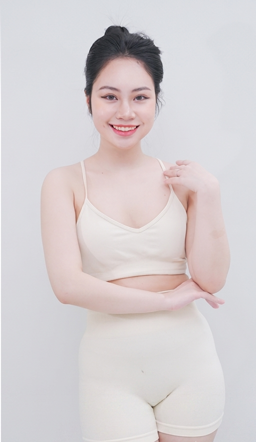 Tắm trắng body – 14 buổi – Tắm trắng cho da ngăm bẩm sinh - sau