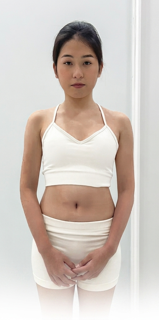 Tắm trắng body – 11 buổi – Tự tin diện đồ biển - trước
