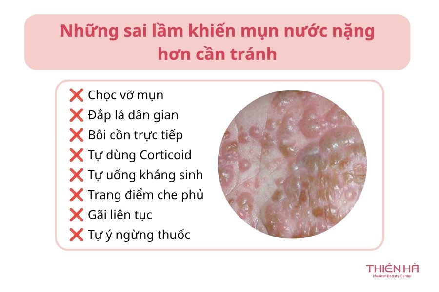 Những sai lầm khiến mụn nước nặng hơn cần tránh