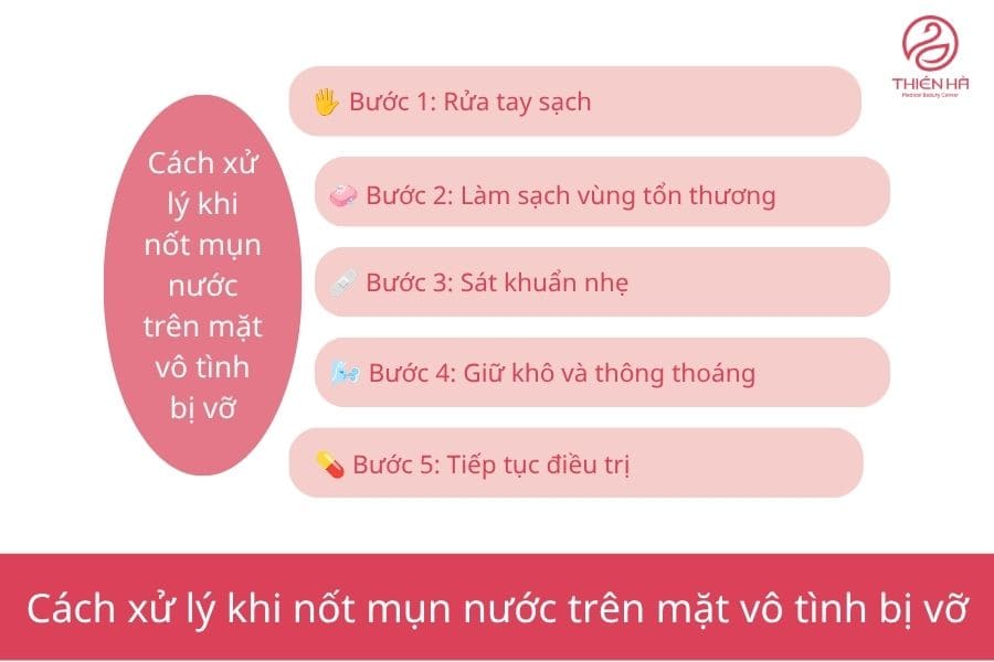 Cách xử lý khi nốt mụn nước trên mặt vô tình bị vỡ