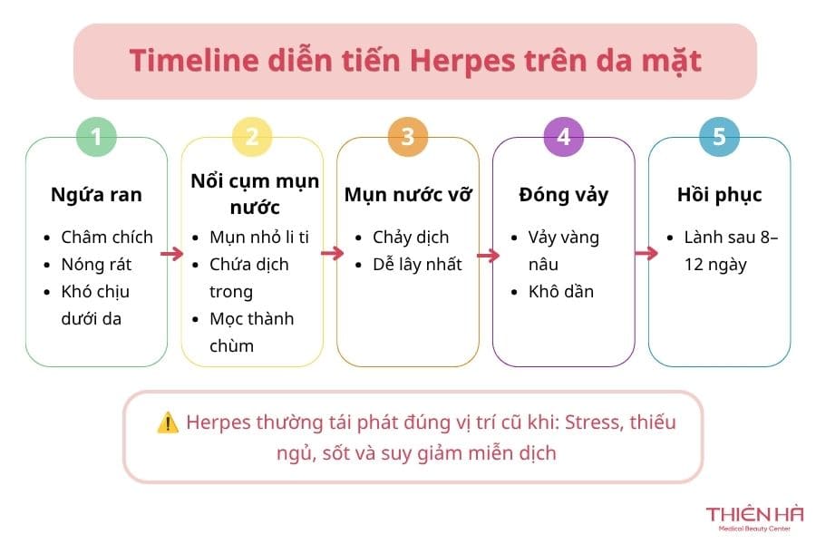 Diễn biến mụn nước ở mặt do nhiễm virus Herpes