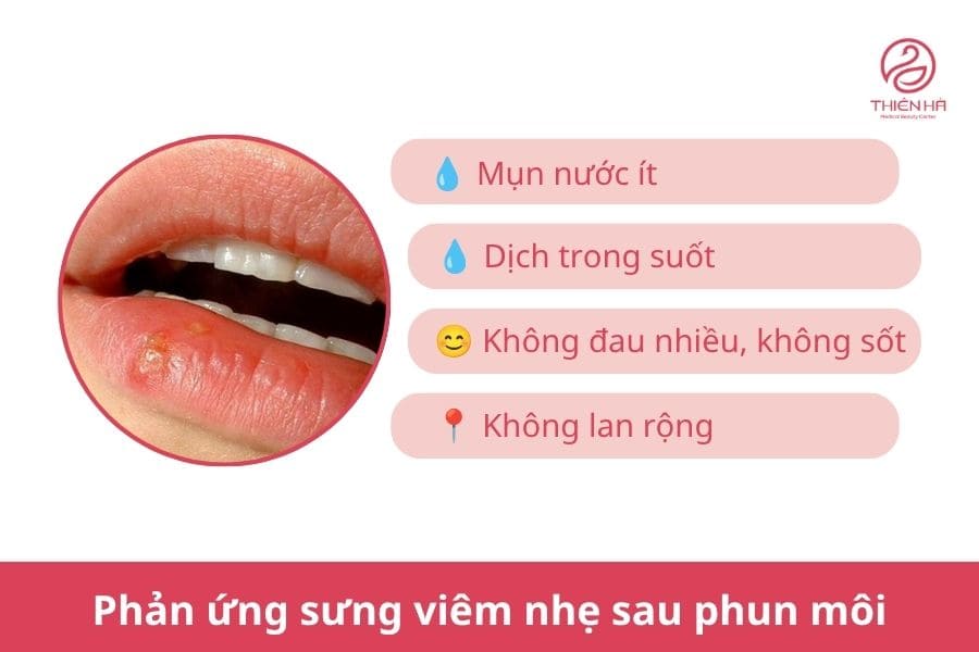 Phun môi bị mụn nước phải làm sao? Hướng dẫn xử lý an toàn 4 Mụn nước xuất hiện chỉ là phản ứng sưng viêm nhẹ bình thường sau phun môi