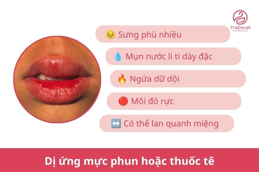 Phun môi bị mụn nước phải làm sao? Hướng dẫn xử lý an toàn 5 Mụn nước do dị ứng mực phun hoặc thuốc tê phun xăm môi