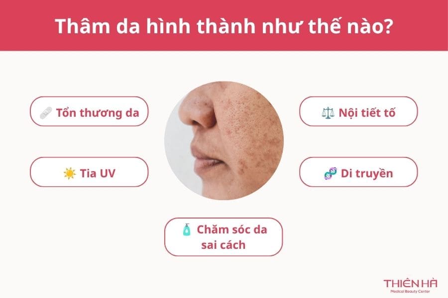 Thâm da hình thành như thế nào?
