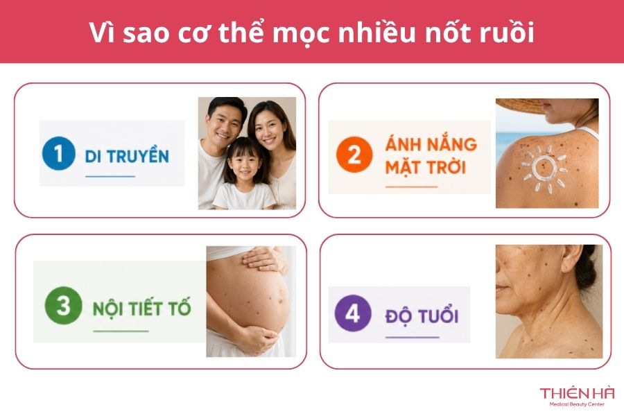 Mọc nhiều nốt ruồi: Có nguy hiểm không và nên xử lý thế nào? 2 Vì sao cơ thể mọc nhiều nốt ruồi?