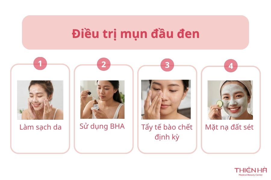 Điều trị mụn đầu đen