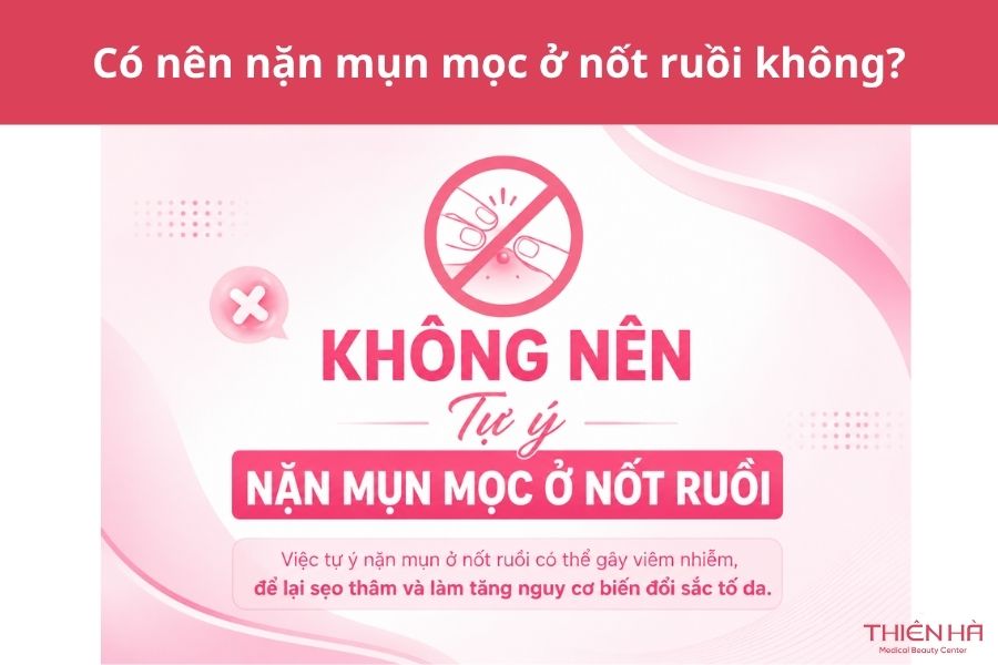 Mụn mọc ở nốt ruồi có nguy hiểm không? Nguyên nhân và cách xử lý 4 Có nên nặn mụn mọc ở nốt ruồi không?