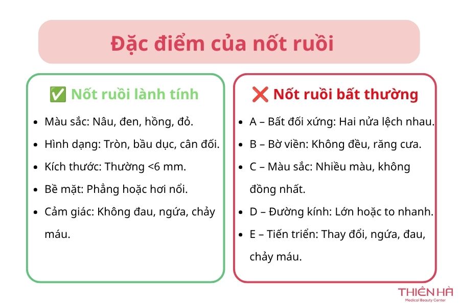 Đặc điểm của nốt ruồi