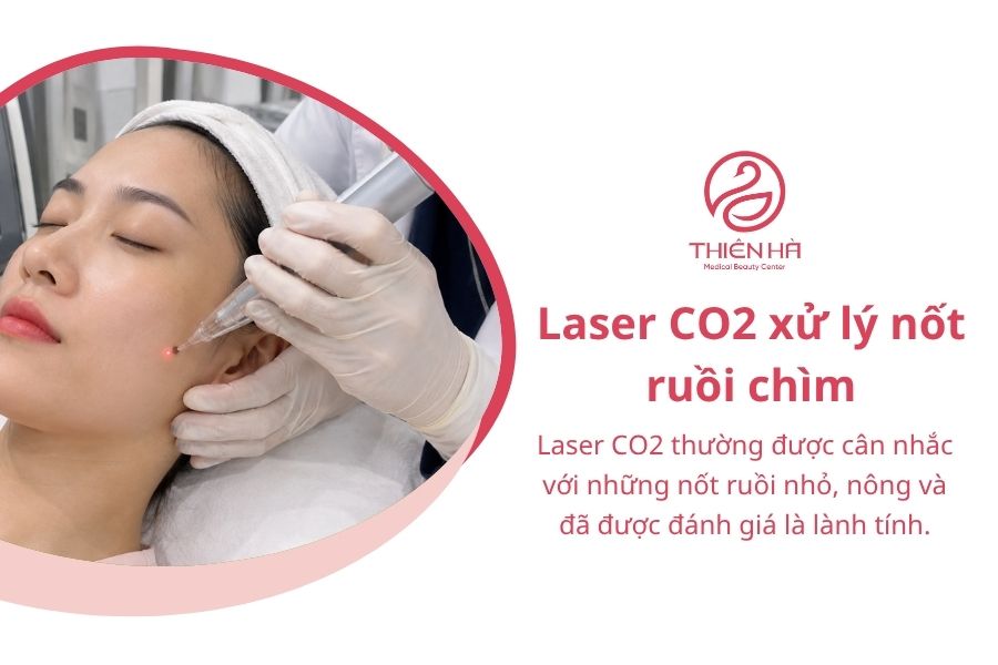 Laser CO2 xử lý nốt ruồi chìm 
