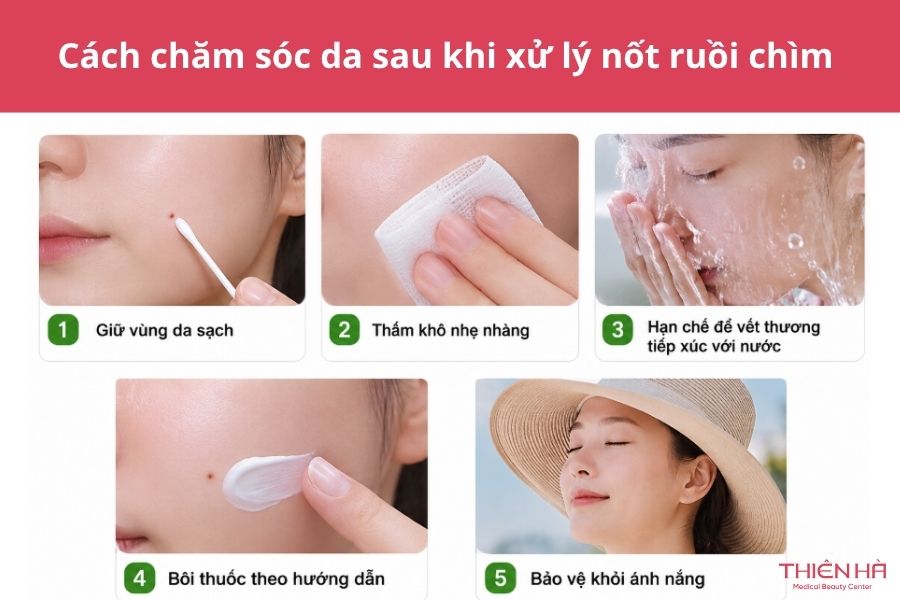 Cách chăm sóc da sau khi xử lý nốt ruồi chìm 