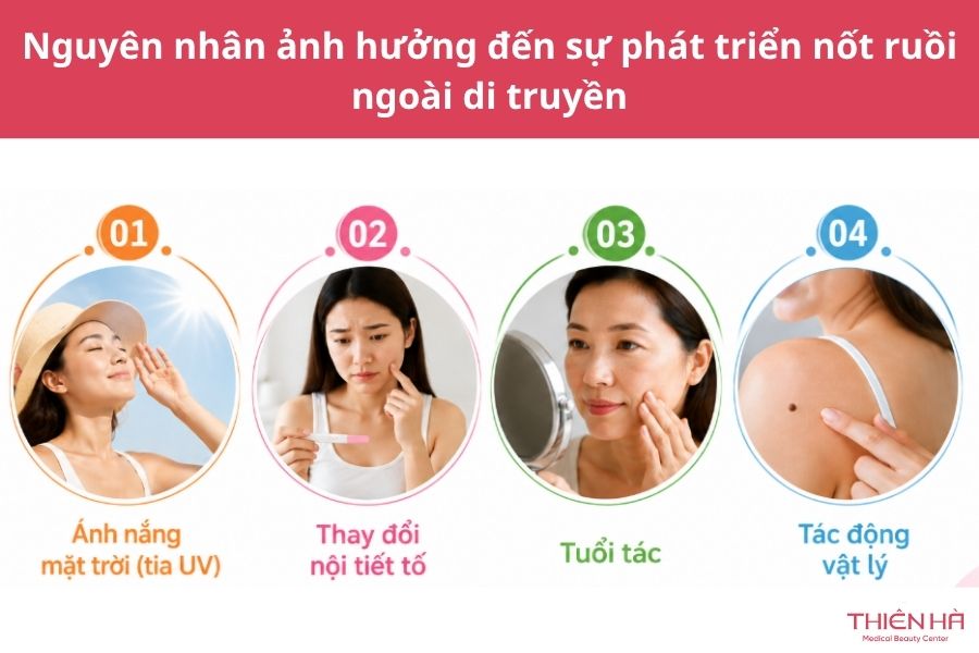 Nốt ruồi có di truyền không? Nguyên nhân và điều cần biết 3 Nguyên nhân ảnh hưởng đến sự phát triển nốt ruồi ngoài di truyền