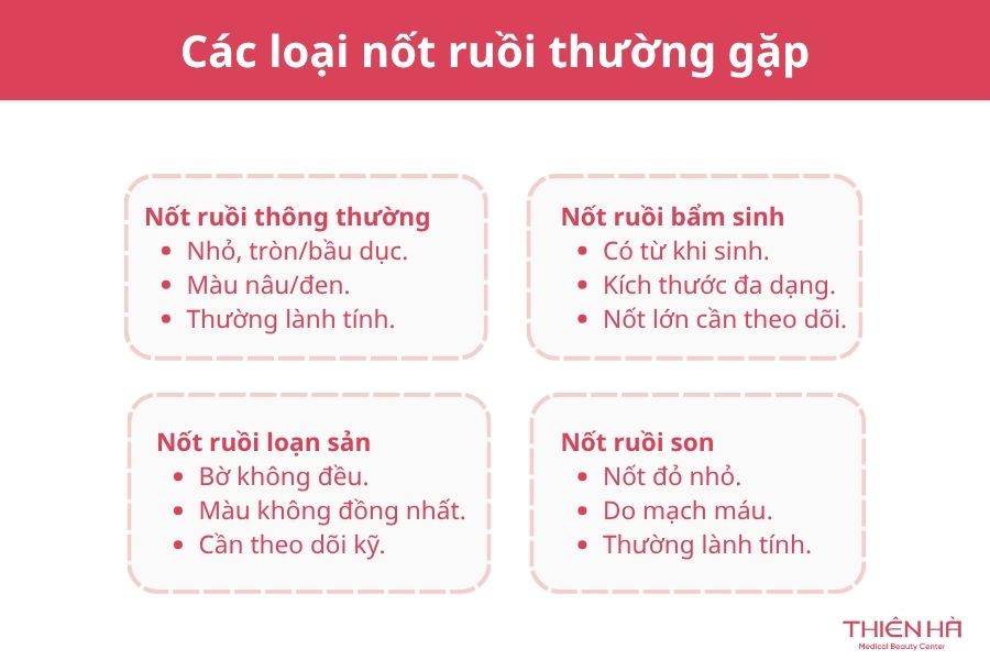 Nốt ruồi có di truyền không? Nguyên nhân và điều cần biết 4 Các loại nốt ruồi thường gặp
