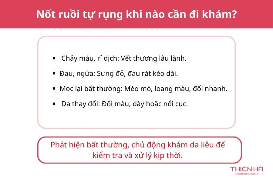 Nốt ruồi tự rụng khi nào cần đi khám?