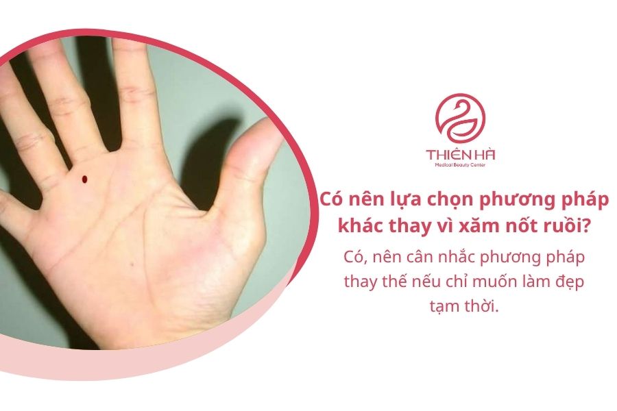 Xăm nốt ruồi có nên không? Vị trí, ý nghĩa và chi phí cần biết 7 Có nên lựa chọn phương pháp khác thay vì xăm nốt ruồi?