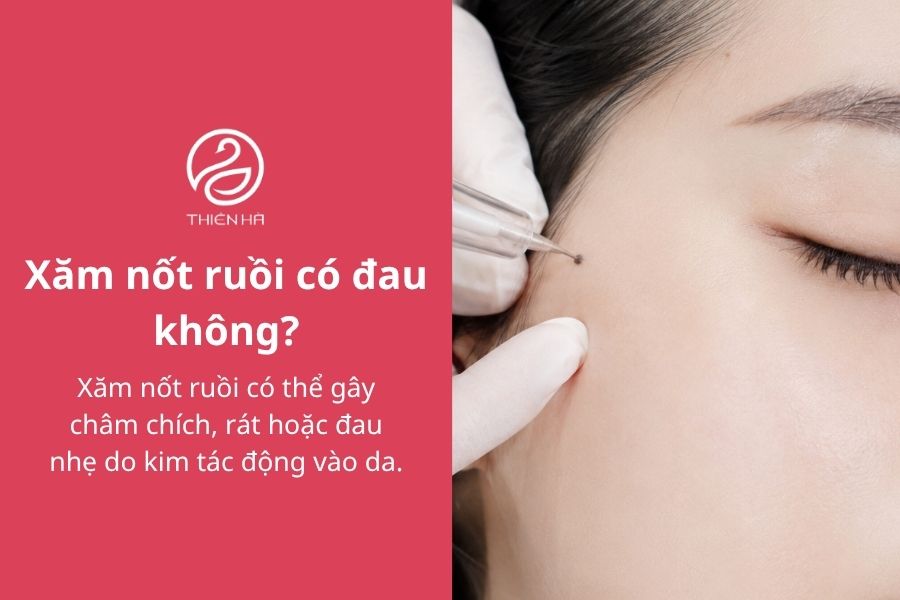 Xăm nốt ruồi có nên không? Vị trí, ý nghĩa và chi phí cần biết 10 Câu hỏi thường gặp về xăm nốt ruồi