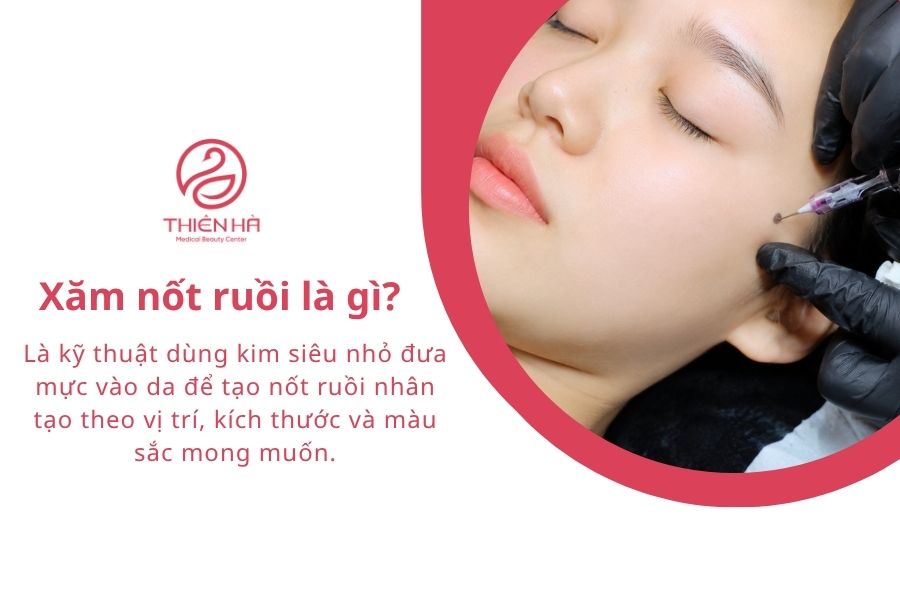 Xăm nốt ruồi có nên không? Vị trí, ý nghĩa và chi phí cần biết 1 Xăm nốt ruồi là gì?