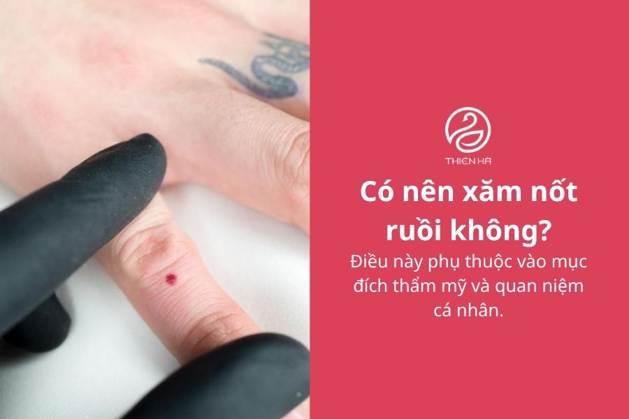 Xăm nốt ruồi có nên không? Vị trí, ý nghĩa và chi phí cần biết 2 Có nên xăm nốt ruồi không?