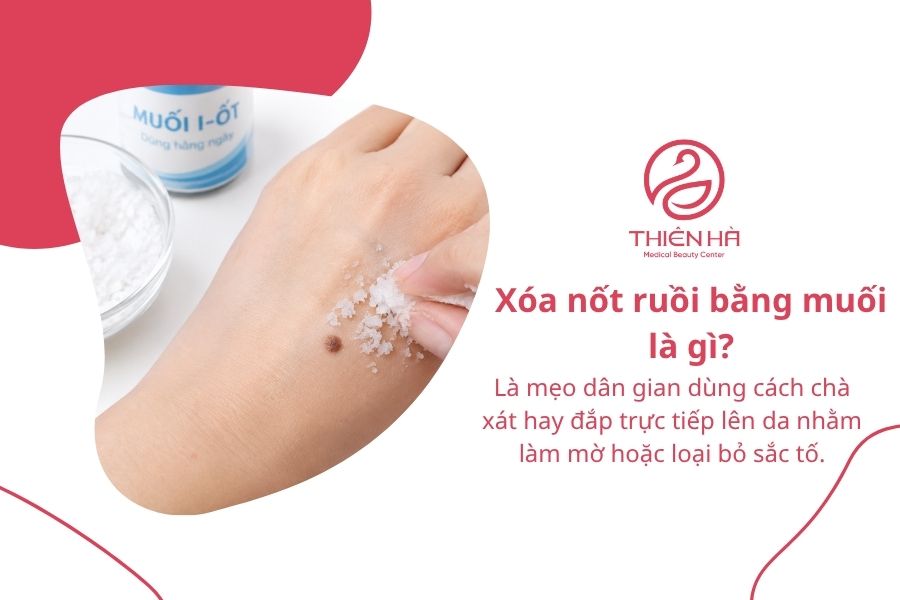 Cách xóa nốt ruồi bằng muối: Hướng dẫn và những rủi ro cần biết 1 Xóa nốt ruồi bằng muối là gì?