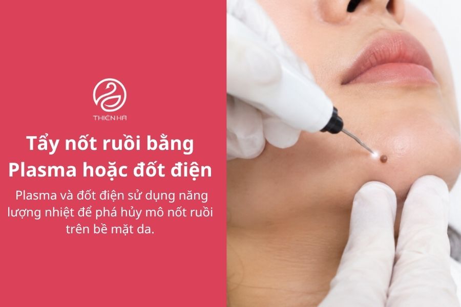 Cách xóa nốt ruồi bằng muối: Hướng dẫn và những rủi ro cần biết 5 Tẩy nốt ruồi bằng Plasma hoặc đốt điện