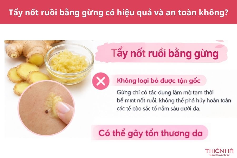 Cách tẩy nốt ruồi bằng gừng: Hướng dẫn và lưu ý quan trọng 3 Tẩy nốt ruồi bằng gừng có hiệu quả và an toàn không?