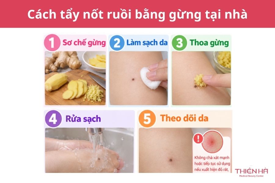 Cách tẩy nốt ruồi bằng gừng: Hướng dẫn và lưu ý quan trọng 2 Cách tẩy nốt ruồi bằng gừng tại nhà
