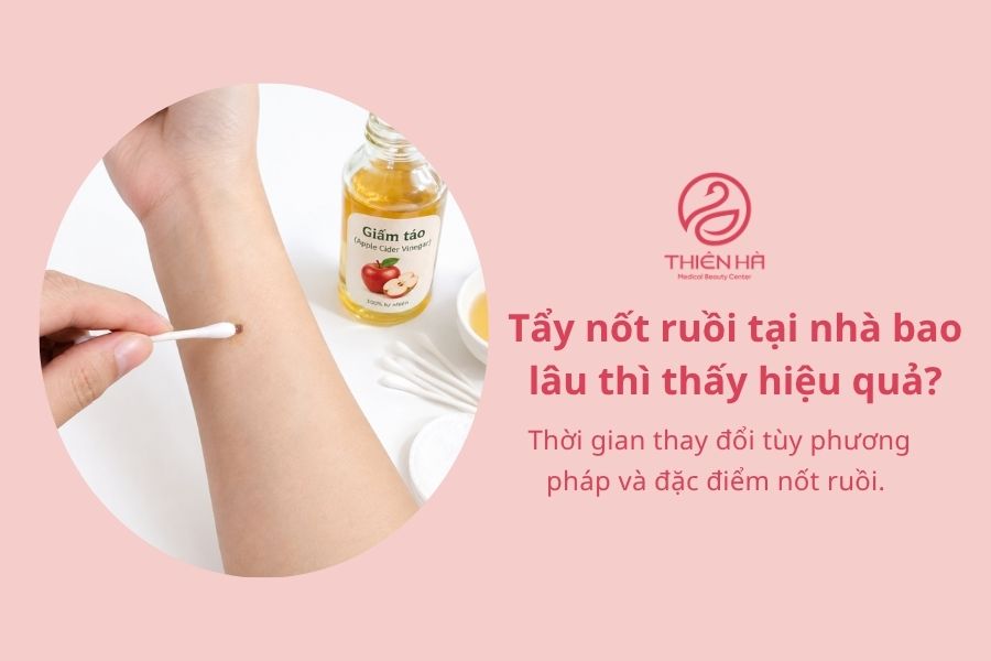 Cách tẩy nốt ruồi tại nhà: 6 cách phổ biến và điều cần biết 10 Câu hỏi thường gặp về cách tẩy nốt ruồi tại nhà