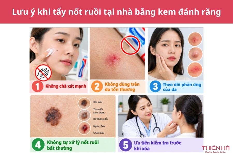 Cách tẩy nốt ruồi tại nhà bằng kem đánh răng và lưu ý an toàn 6 Tẩy nốt ruồi tại nhà bằng kem đánh răng nên lưu ý điều gì?
