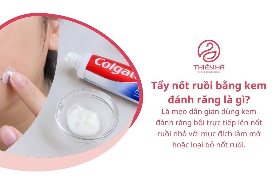 Cách tẩy nốt ruồi tại nhà bằng kem đánh răng và lưu ý an toàn 1 Tẩy nốt ruồi bằng kem đánh răng là gì?