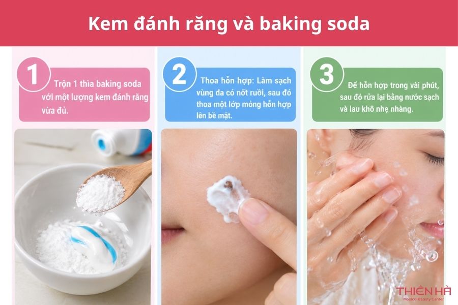 Cách tẩy nốt ruồi tại nhà bằng kem đánh răng và lưu ý an toàn 3 Kem đánh răng và baking soda