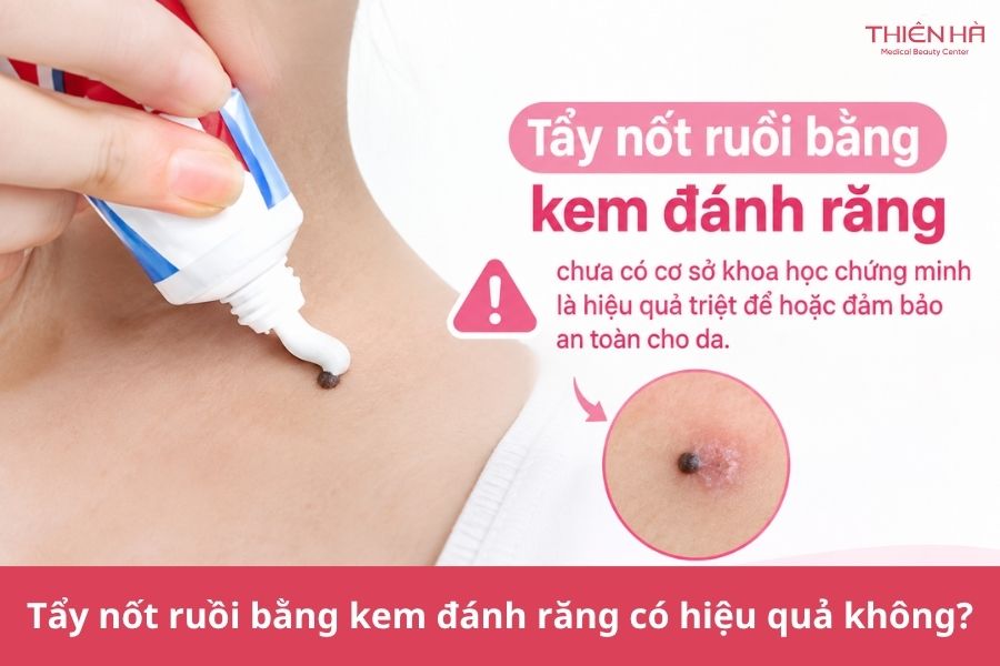 Cách tẩy nốt ruồi tại nhà bằng kem đánh răng và lưu ý an toàn 5 Tẩy nốt ruồi bằng kem đánh răng có hiệu quả không?