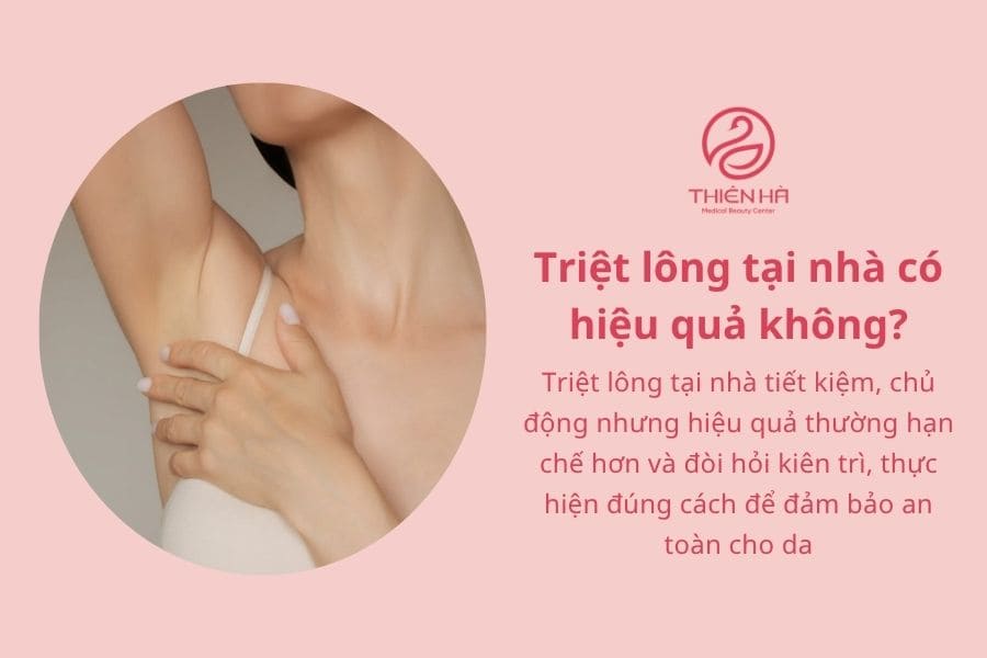 Triệt lông tại nhà có hiệu quả không? Ưu và nhược điểm