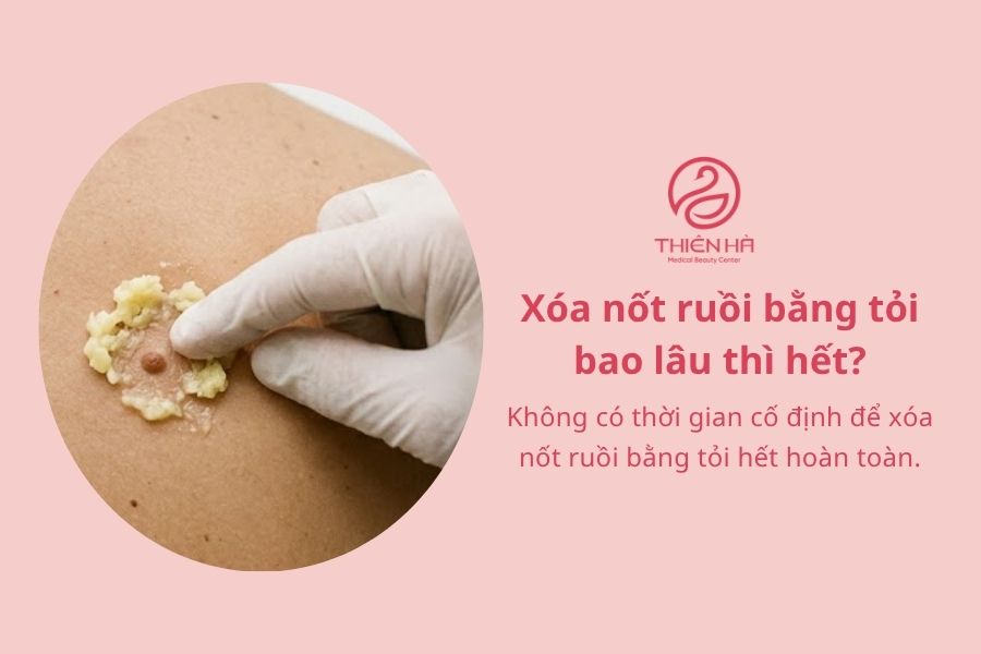 Cách xóa nốt ruồi tại nhà bằng tỏi: Hướng dẫn và lưu ý an toàn 11 Câu hỏi thường gặp về xóa nốt ruồi bằng tỏi